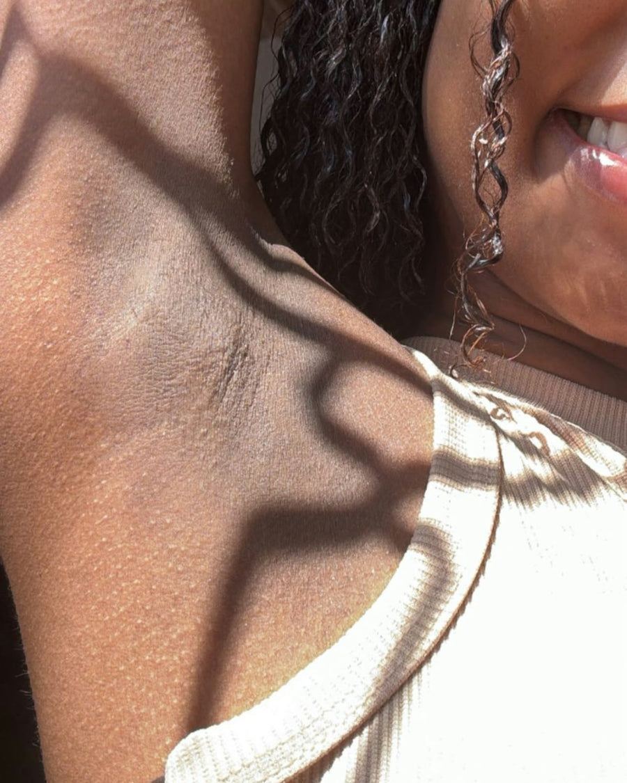 Depois do tratamento Skin Tone