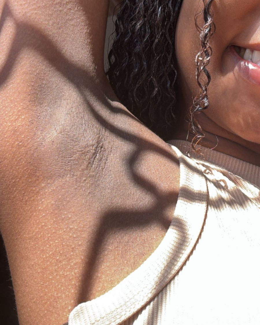 Depois do uso do creme clareador Skin Tone na axila
